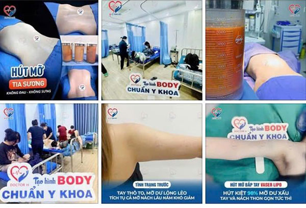 Một số nội dung quảng cáo dịch vụ thẩm mỹ của cơ sở Julia Aesthetic được đăng tải trên mạng xã hội